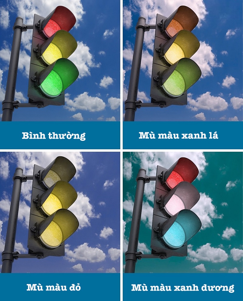 Bệnh mù màu là gì?