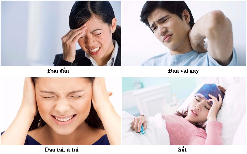 Triệu chứng của viêm xoang