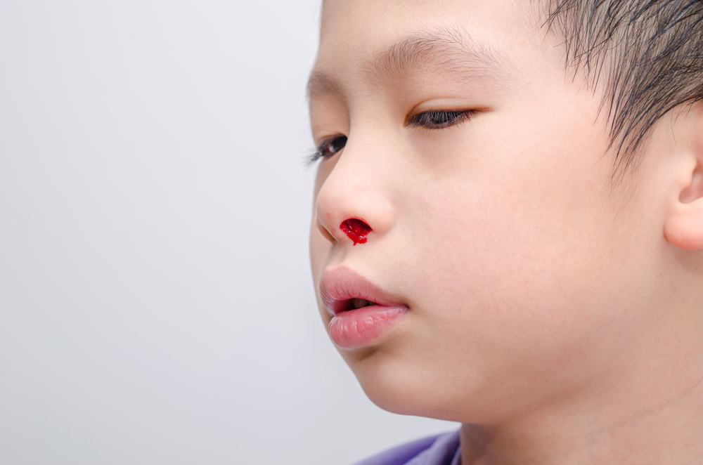 những bệnh gây chảy máu cam