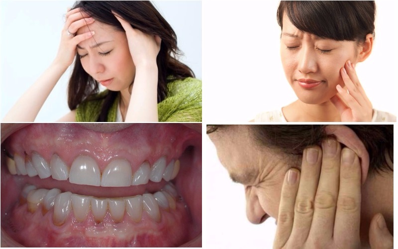 Hậu quả của việc nghiến răng