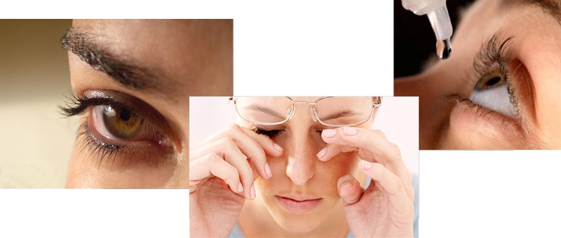 Khô và nhức mỏi mắt là gì?