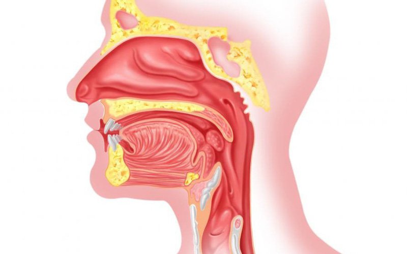 Các bệnh thường gặp ở tai mũi họng