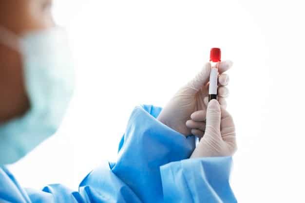 xét nghiệm máu chẩn đoán hội chứng suy hô hấp cấp nặng