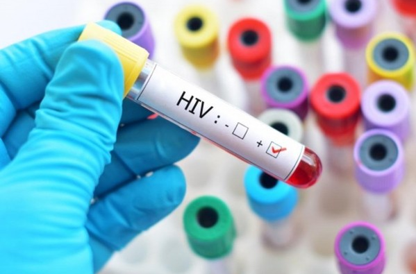 HIV dương tính là gì
