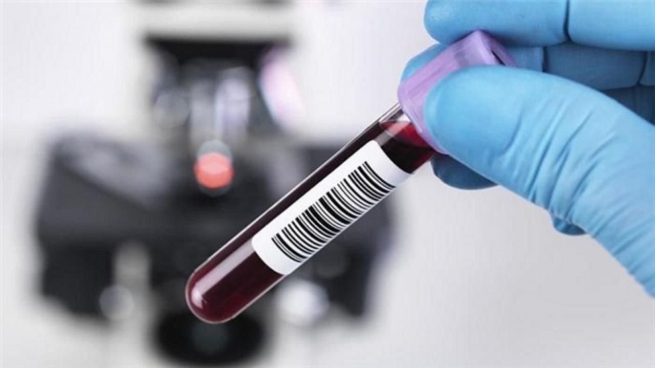 Hướng dẫn xem kết quả xét nghiệm viêm gan B