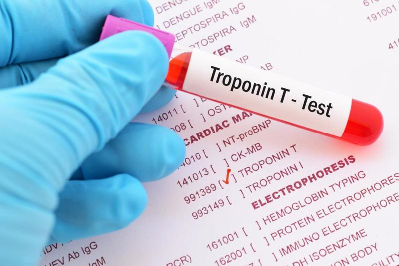  Xét nghiệm Troponin thường dùng trong chẩn đoán nhồi máu cơ tim