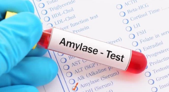 Amylase máu và nước tiểu